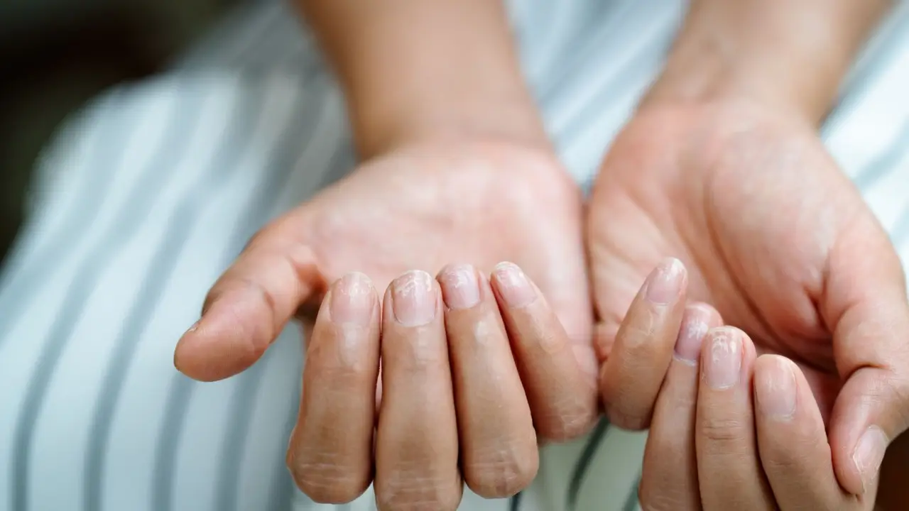 Le tue unghie potrebbero rivelare quanto vivrai: ecco come fare a scoprirlo Immagine selezionata