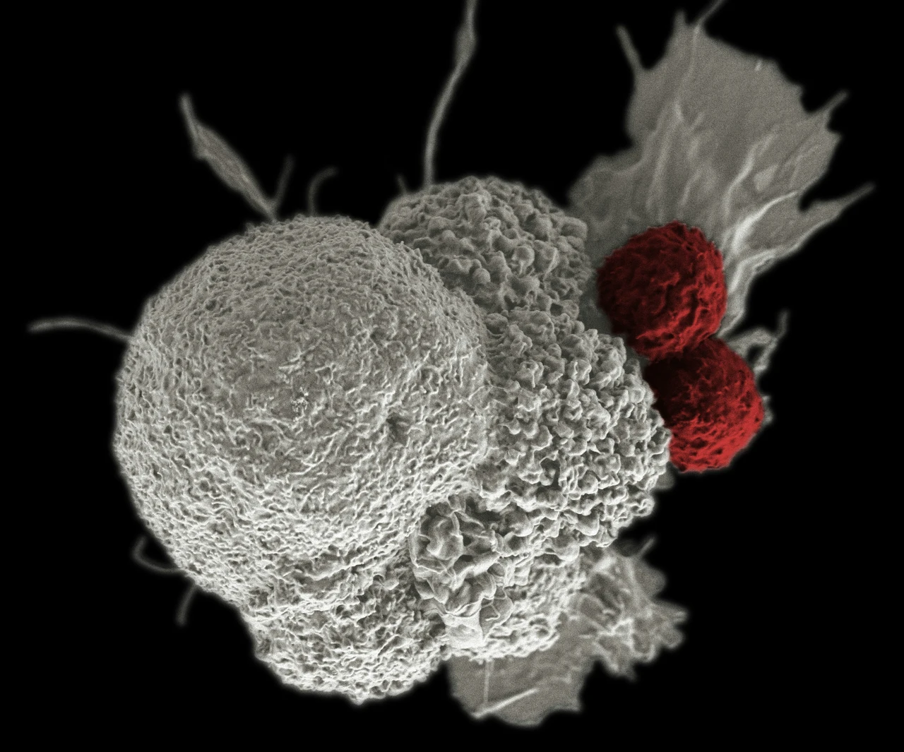 Scoperta shock: ecco un vecchio farmaco anti-parassiti può combattere il melanoma più aggressivo Immagine selezionata